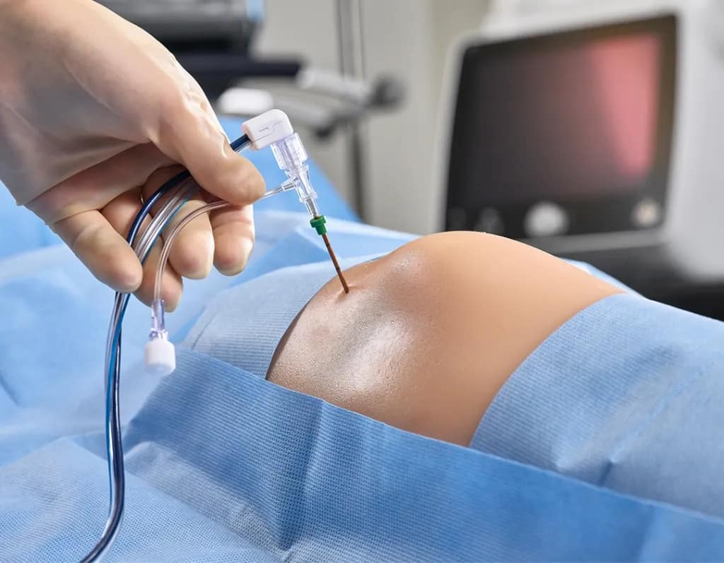 Procedimiento para manejo del dolor